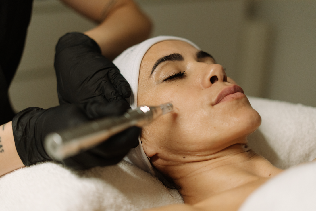 Microneedling con Exosomas en Picanya: La revolución de la regeneración celular